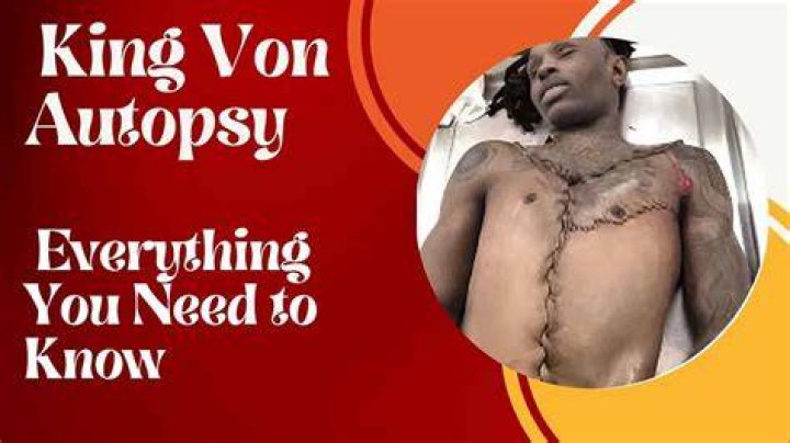 Disturbing Details: King Von Autopsy Picture Analysis And Aftermath