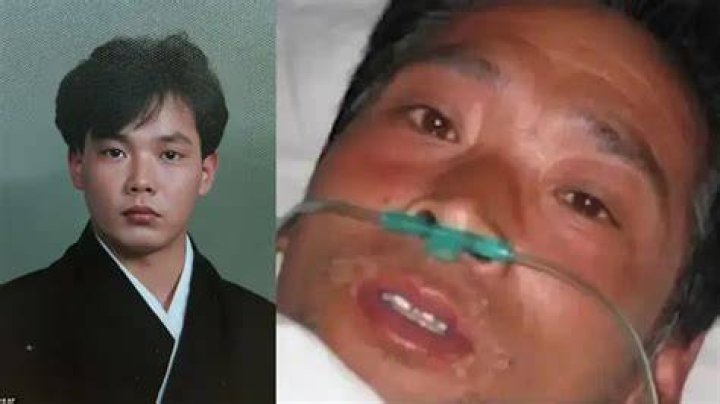 Hisashi Ouchi's Hospital Photos Reveal Devastating Effects