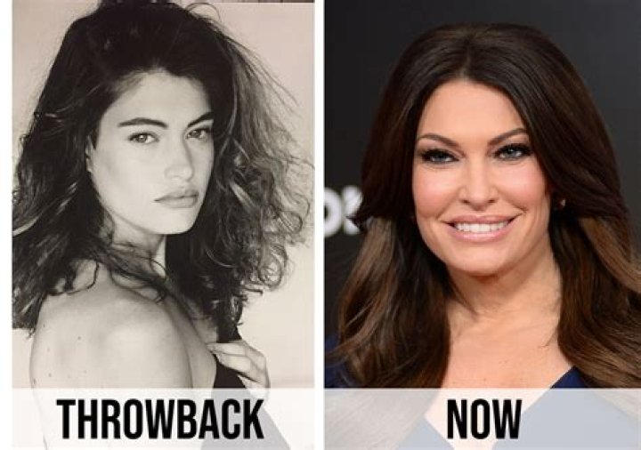 Kimberly Guilfoyle's Plastic Surgery: What Procedures Has She Had?