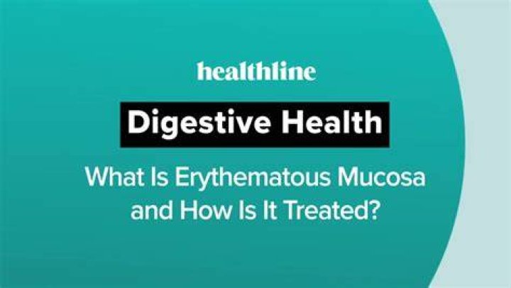 Understanding Erythematous Mucosa: Causes, Symptoms, And Treatment
