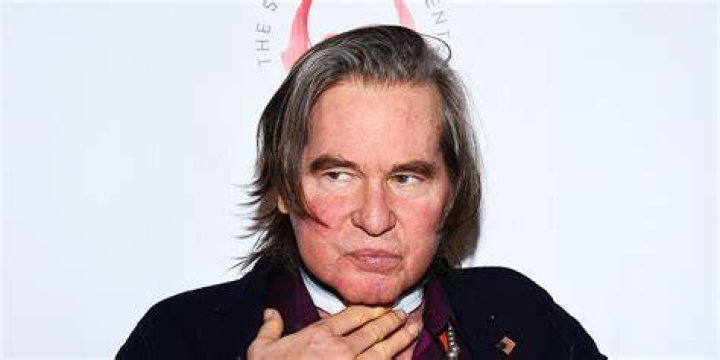 Unraveling Val Kilmer's Face Surgery: A Journey Of Resilience And Triumph